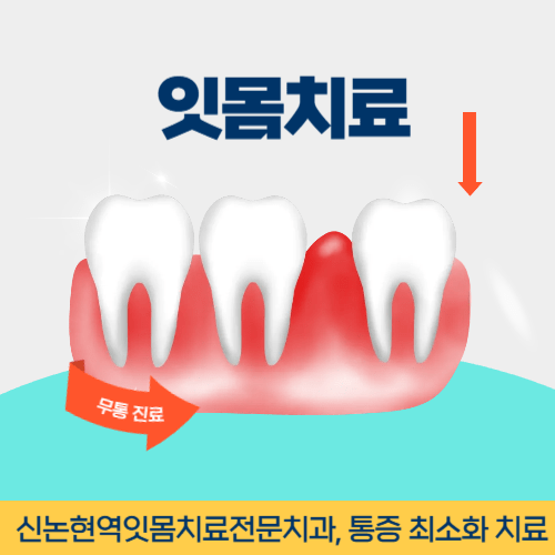 서울치과 서울특별시 치과 잇몸치료